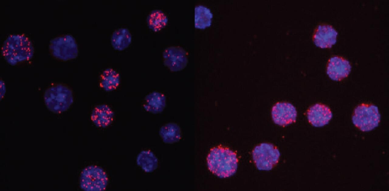 How cells rewrite their fate | Max Delbrück Center