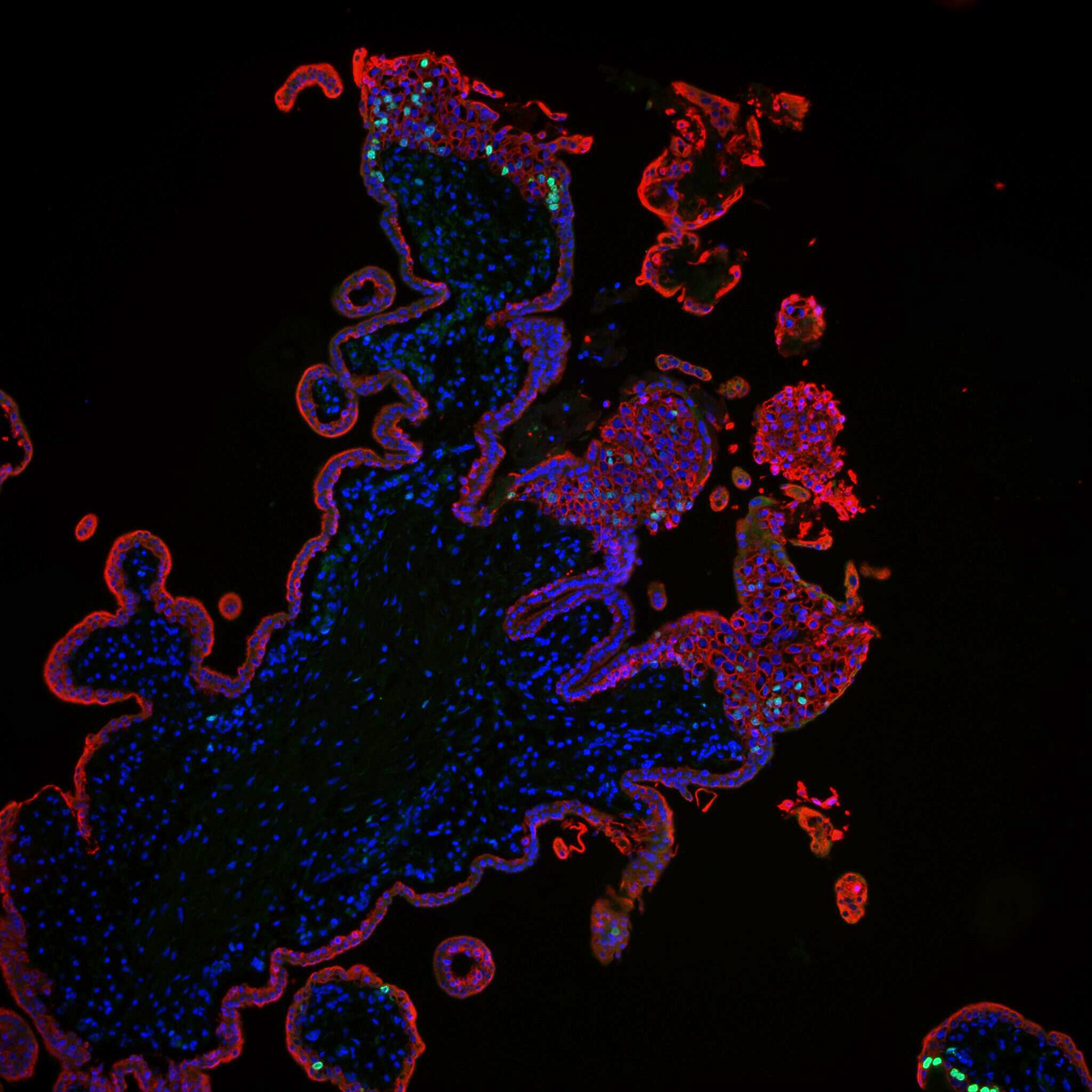 拙作「Placenta」 Ancient viral DNA shapes modern human placentas | Max Delbrück Center