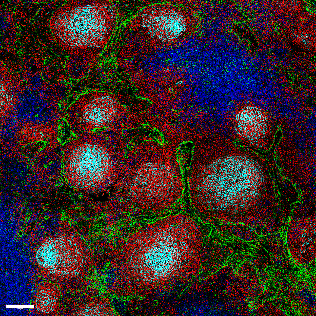 Chaos in the lymph node promotes cancer | MDC Connect