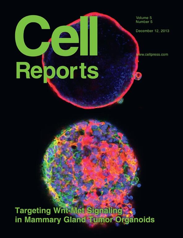 Mdc Forscher Warum Der Basale Brustkrebs So Aggressiv Sein Kann Mdc Berlin
