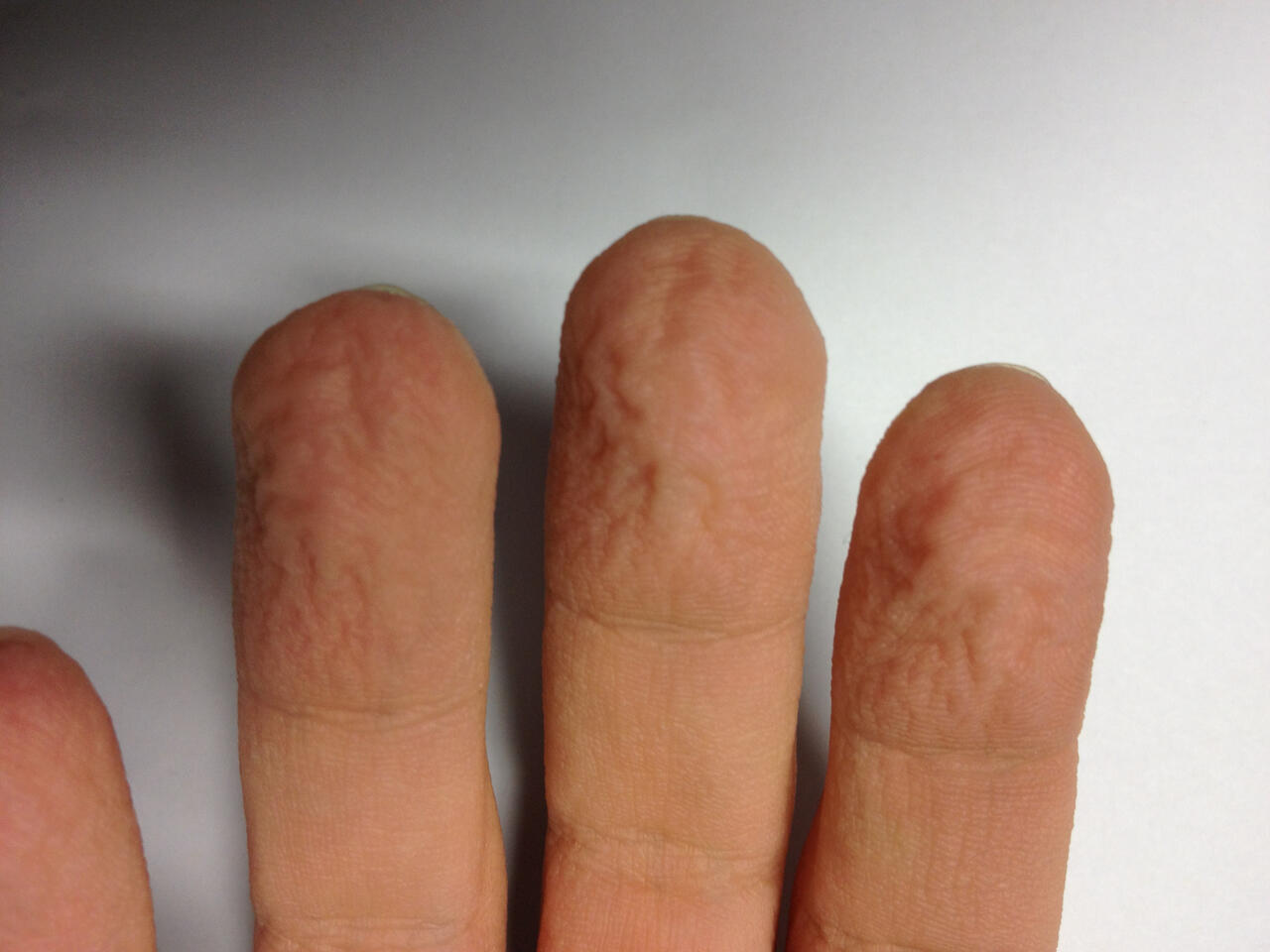 Better Grip with Wrinkly Fingers? MDCResearchers find no Proof Max