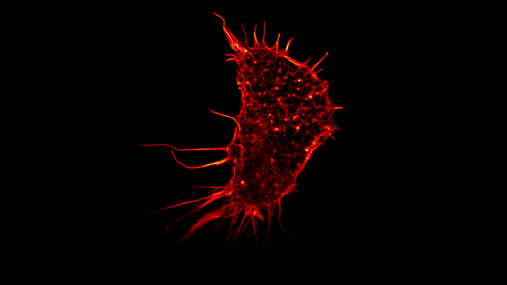 Mikroskopische Aufnahme einer einzelnen menschlichen Nierenzelle