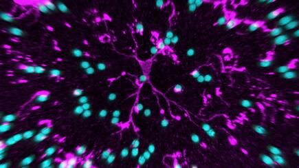 Unter dem Mikrsokop: Mikroglia mit Latexkügelchen