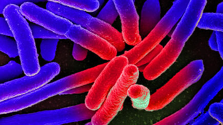 Escherichia coli under the microscope