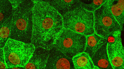 Fluconazole in rat kidney cells, AQP2 marked green