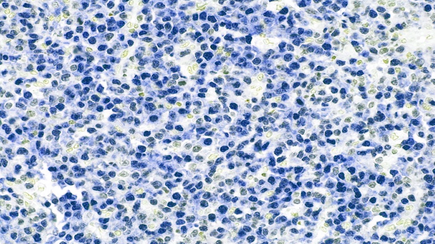 Microscopic image of IRF4