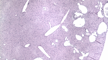 stained tissue sections of a mouse liver after base editing