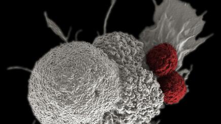 T-cells (highlighted red) attacking a cancer cell