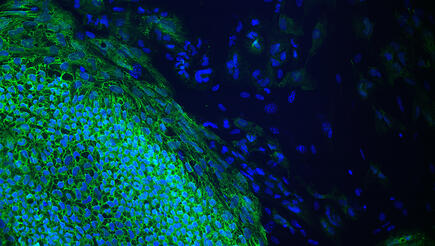 induced pluripotent stem cells in a pluripotency test