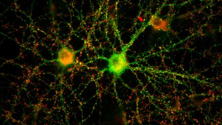Ein neuronales Netzwerk aus zwei Nervenzellen in der Petrischale