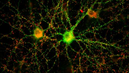 A neuronal network of two nerve cells in the petri dish