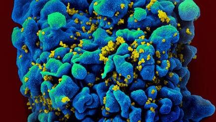 HIV-infected H9 T cell