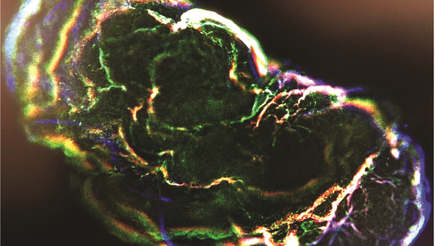Heart and brain organoid