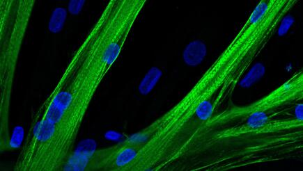 muscle stem cells fused into multinucleated myotubes