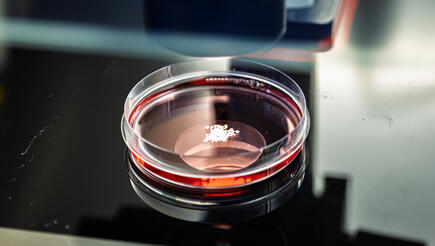 Organoids in petri dish