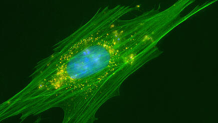 Protein degeneration in the heart