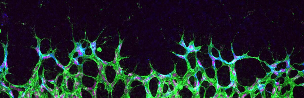 First-of-its-kind live imaging leads to major discovery in how cells  pattern in tissues - Northwestern Now
