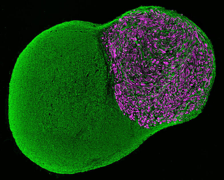 Neuromuscular organoid: It’s contracting! | MDC Berlin